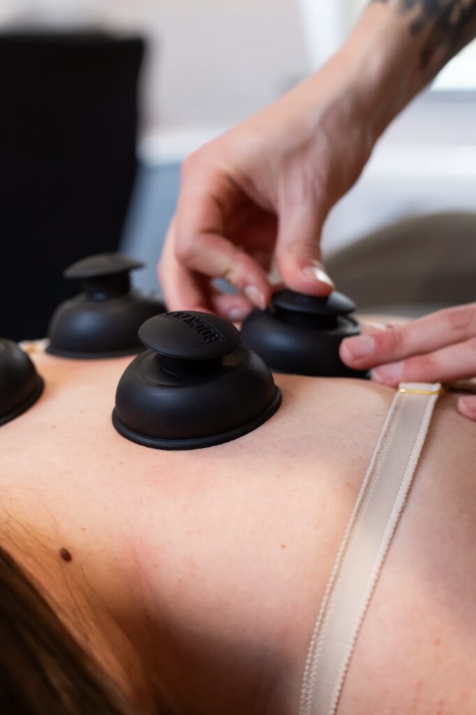 Cupping Therapy 1 Image 22