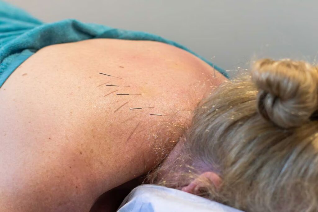 Medical Acupuncture 2 Image 27 1