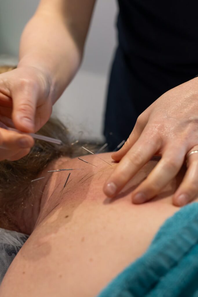 Medical Acupuncture 1 Image 29