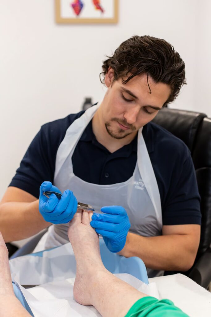 Ingrown Toenails 1 Image 41